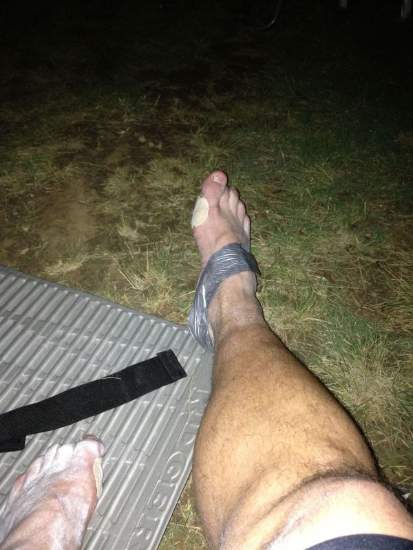 Foot aftermath after loop 3. Yes, that is Duct Tape holding my heel blister in from rubbing.